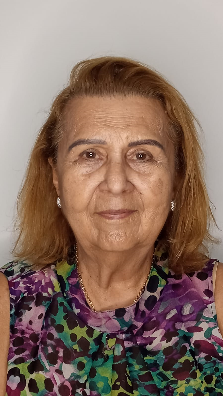Resultado Antes - Harmonização Facial