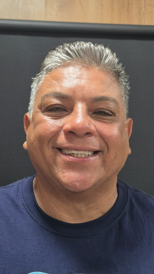Resultado Depois - Aplicação de Botox